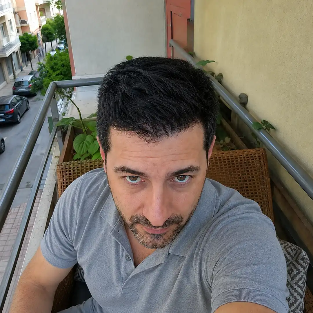 Suivi à 12 mois, vue de droite, cas HNS-0041