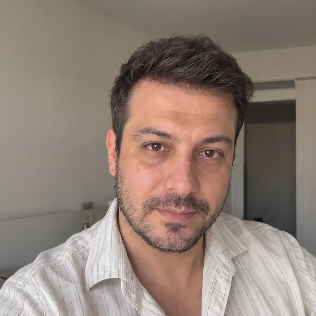 Follow-up a 12 mesi, vista frontale, caso documentato HNS-0049