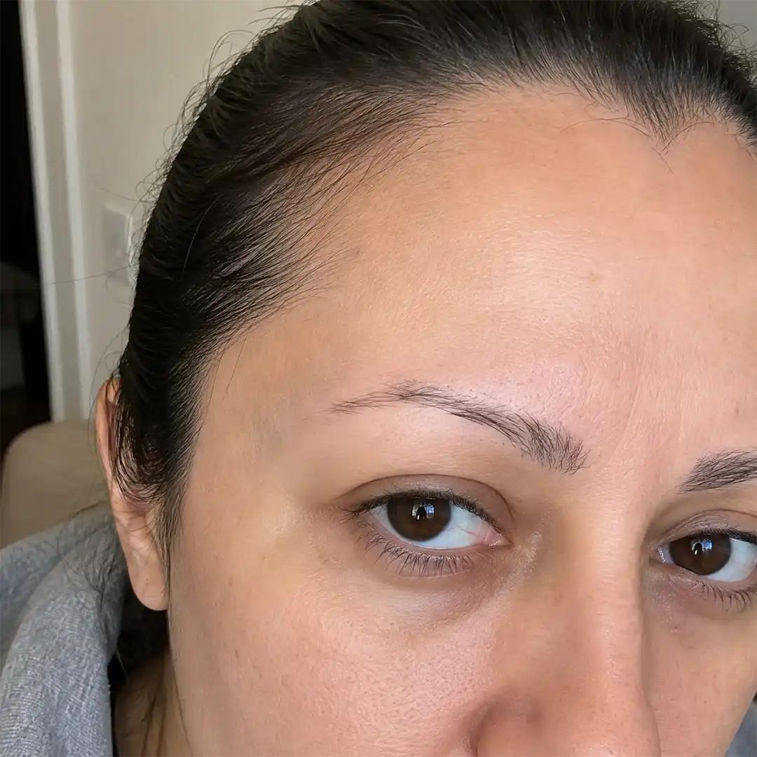 Pre-treatment right view from documented case HNS-0057