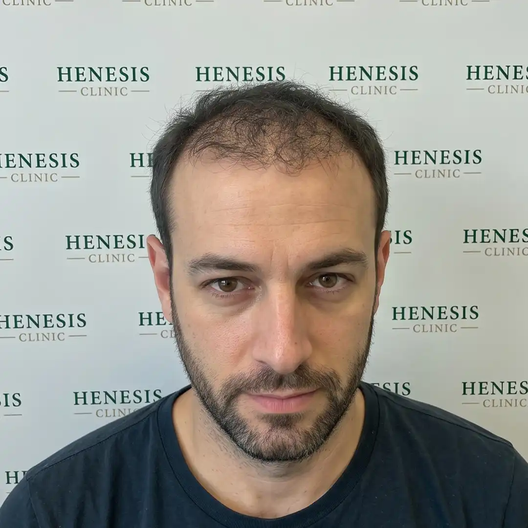 Procedure front view from documented case HNS-0070